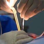 smart strategies for complications management