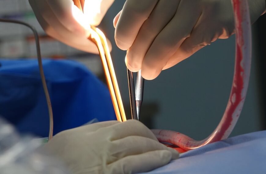 smart strategies for complications management